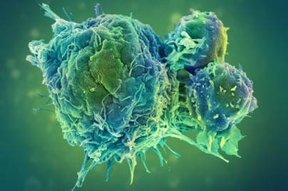 Oncology