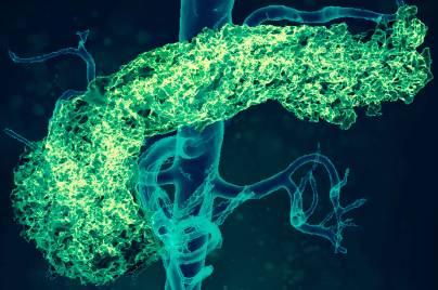 Our work in diabetes