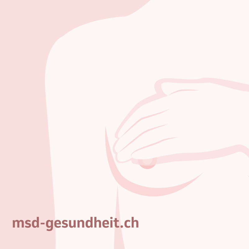Banner: website about breast cancer