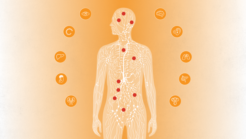 Image for What is Von Hippel-Lindau disease?
