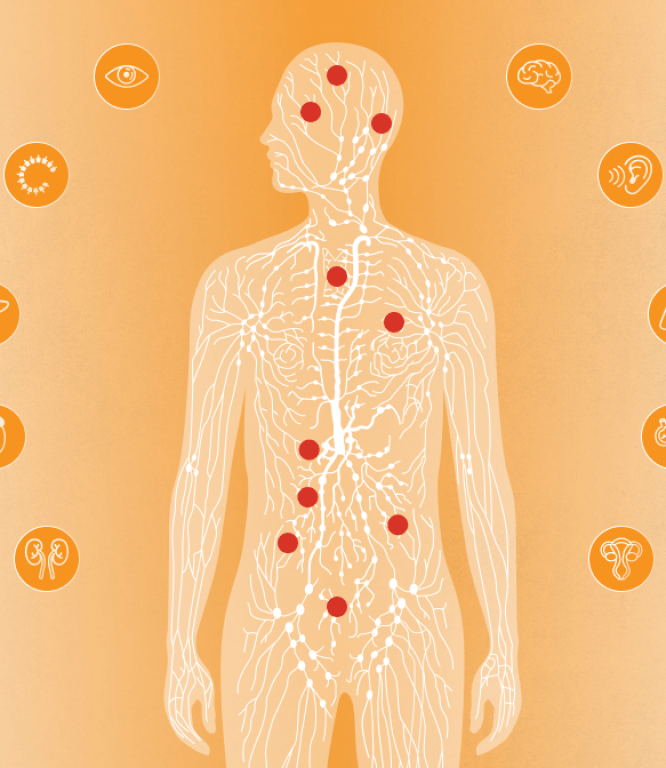 Image for What is Von Hippel-Lindau disease?