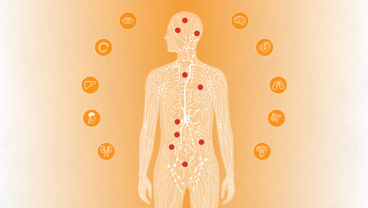 Picture: the human body and the places where VHL can cause tumors and cysts