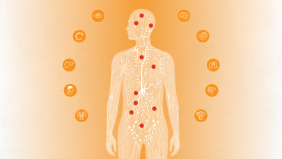 What is Von Hippel-Lindau disease?